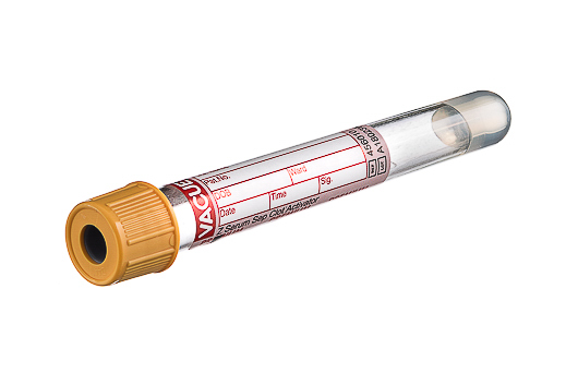 Greiner Bio-One - VACUETTE® RÖHRCHEN 5 ml CAT Serum Separator Gerinnungsaktivator - 456010