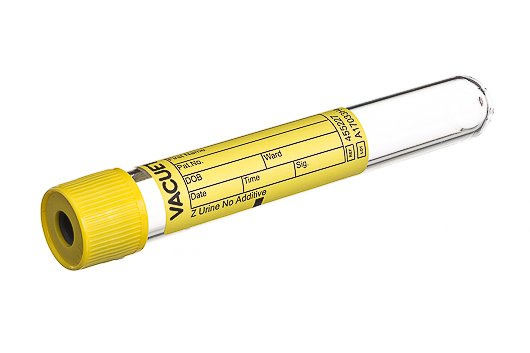 Greiner Bio-One - VACUETTE® RÖHRCHEN 7 ml Z Urin Ohne Zusatz - 455227
