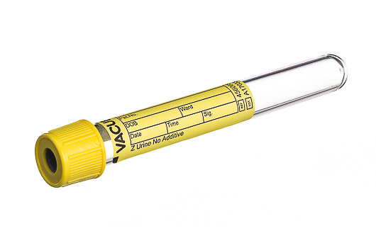 Greiner Bio-One - VACUETTE® RÖHRCHEN 6 ml Z Urin Ohne Zusatz - 456065