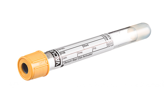 Greiner Bio-One - VACUETTE® TUBE 5 ml CAT Serum Separator Clot Activator - 456018