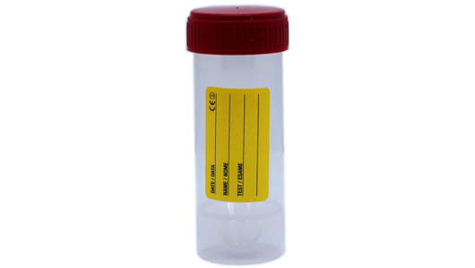 Greiner Bio-One - 30ml beaker, PP, red screw cap - 25176E