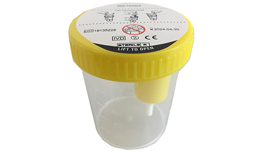 Greiner Bio-One - Urine Beaker with integrated Transfer Device 120 ml, yellow lid - 724323