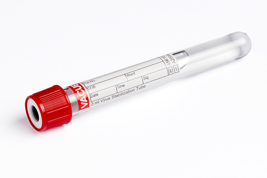Greiner Bio-One - VACUETTE® 3 ml Virus Stabilization Tube - 456161
