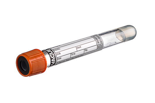 Greiner Bio-One - VACUETTE® TUBE 5 ml CAT Serum Separator Clot Activator - 456079