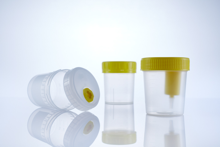 Pots à urine - Greiner Bio-One