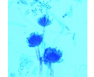 Greiner Bio-One - Bleu de Lactophenol MERCK, sol. 100ml - BLACM