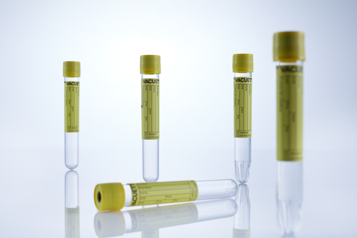 Tubes urine sans additif - Greiner Bio-One