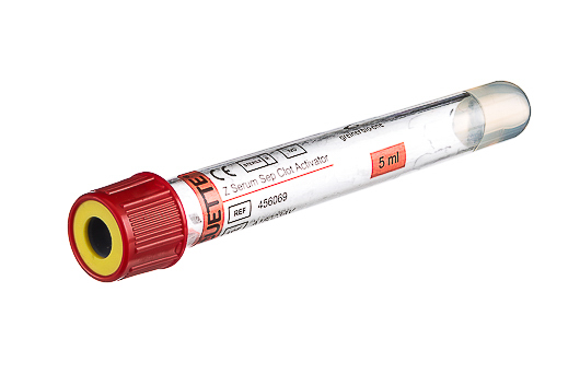 Greiner Bio-One - VACUETTE® TUBE 5 ml CAT Serum Separator Clot Activator - 456069