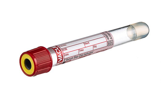 Greiner Bio-One - Szérumcső géles 5 ml - 456071
