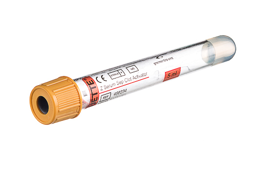 Greiner Bio-One - VACUETTE® PROVETTA 5 ml Siero con attivatore e gel separatore - 456234