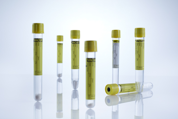 Barcode urine buizen - Greiner Bio-One