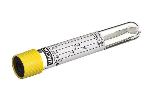 Greiner Bio-One - Tubo para Tipagem Sanguínea VACUETTE® 9 ml ACD-A - 455055